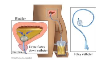 &Sigma;&Epsilon;&Tau; &Alpha;&Lambda;&Lambda;&Alpha;&Gamma;&Eta;&Sigma; &Omicron;&Upsilon;&Rho;&Omicron;&Kappa;&Alpha;&Theta;&Epsilon;&Tau;&Eta;&Rho;&Alpha;