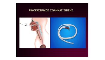 &Sigma;&Epsilon;&Tau; &Alpha;&Lambda;&Lambda;&Alpha;&Gamma;&Eta;&Sigma; &Kappa;&Alpha;&Theta;&Epsilon;&Tau;&Eta;&Rho;&Alpha; &Sigma;&Iota;&Tau;&Iota;&Sigma;&Eta;&Sigma;