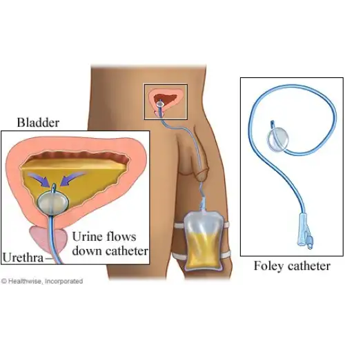&Sigma;&Epsilon;&Tau; &Alpha;&Lambda;&Lambda;&Alpha;&Gamma;&Eta;&Sigma; &Omicron;&Upsilon;&Rho;&Omicron;&Kappa;&Alpha;&Theta;&Epsilon;&Tau;&Eta;&Rho;&Alpha;