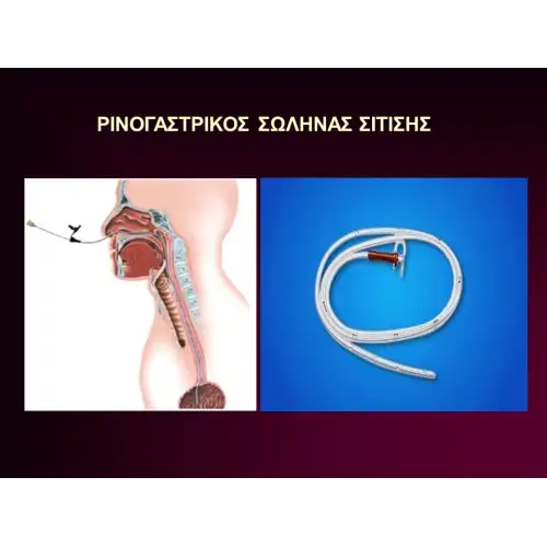 &Sigma;&Epsilon;&Tau; &Alpha;&Lambda;&Lambda;&Alpha;&Gamma;&Eta;&Sigma; &Kappa;&Alpha;&Theta;&Epsilon;&Tau;&Eta;&Rho;&Alpha; &Sigma;&Iota;&Tau;&Iota;&Sigma;&Eta;&Sigma;