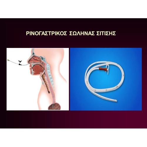 ΣΕΤ ΑΛΛΑΓΗΣ ΚΑΘΕΤΗΡΑ ΣΙΤΙΣΗΣ