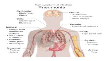 &Pi;&nu;&epsilon;&upsilon;&mu;&omicron;&nu;ί&alpha;: &Sigma;&upsilon;&mu;&pi;&tau;ώ&mu;&alpha;&tau;&alpha; &kappa;&alpha;&iota; &alpha;&nu;&tau;&iota;&mu;&epsilon;&tau;ώ&pi;&iota;&sigma;&eta; 