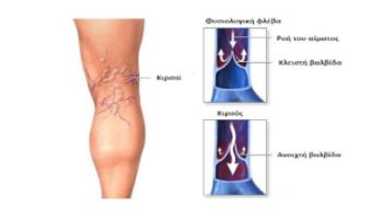 &Phi;&lambda;&epsilon;&beta;ί&tau;&iota;&delta;&alpha;