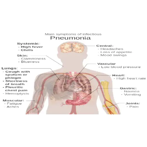 &Pi;&nu;&epsilon;&upsilon;&mu;&omicron;&nu;ί&alpha;: &Sigma;&upsilon;&mu;&pi;&tau;ώ&mu;&alpha;&tau;&alpha; &kappa;&alpha;&iota; &alpha;&nu;&tau;&iota;&mu;&epsilon;&tau;ώ&pi;&iota;&sigma;&eta; 