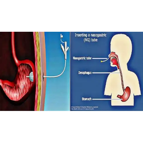 &Gamma;&alpha;&sigma;&tau;&rho;&omicron;&sigma;&tau;&omicron;&mu;ί&alpha; & &Rho;&iota;&nu;o&gamma;&alpha;&sigma;&tau;&rho;&iota;&kappa;ό&sigmaf; &sigma;&omega;&lambda;ή&nu;&alpha;&sigmaf; ( Levin)
