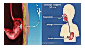 &Gamma;&alpha;&sigma;&tau;&rho;&omicron;&sigma;&tau;&omicron;&mu;ί&alpha; & &Rho;&iota;&nu;o&gamma;&alpha;&sigma;&tau;&rho;&iota;&kappa;ό&sigmaf; &sigma;&omega;&lambda;ή&nu;&alpha;&sigmaf; ( Levin)
