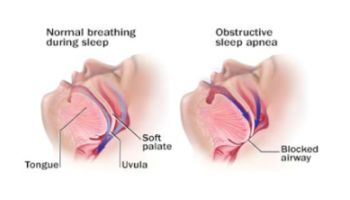 &Upsilon;&pi;&nu;&iota;&kappa;ή ά&pi;&nu;&omicron;&iota;&alpha;: &omicron; &epsilon;&pi;&iota;&kappa;ί&nu;&delta;&upsilon;&nu;&omicron;&sigmaf; &nu;&upsilon;&chi;&tau;&epsilon;&rho;&iota;&nu;ό&sigmaf; &epsilon;&chi;&theta;&rho;ό&sigmaf; &mu;&alpha;&sigmaf;!