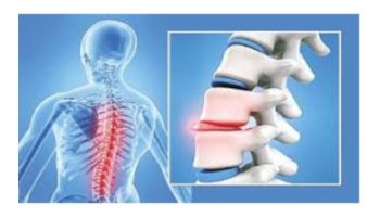 &Kappa;ή&lambda;&eta; &Mu;&epsilon;&sigma;&omicron;&sigma;&pi;&omicron;&nu;&delta;ύ&lambda;&iota;&omicron;&upsilon; &Delta;ί&sigma;&kappa;&omicron;&upsilon; 