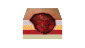 &Pi;&epsilon;&rho;&iota;&pi;&omicron;ί&eta;&sigma;&eta; &kappa;&alpha;&tau;&alpha;&kappa;&lambda;ί&sigma;&epsilon;&omega;&nu;