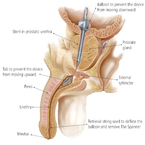 &Tau;&omicron;&pi;&omicron;&theta;έ&tau;&eta;&sigma;&eta; &omicron;&upsilon;&rho;&omicron;&kappa;&alpha;&theta;&epsilon;&tau;ή&rho;&alpha; 