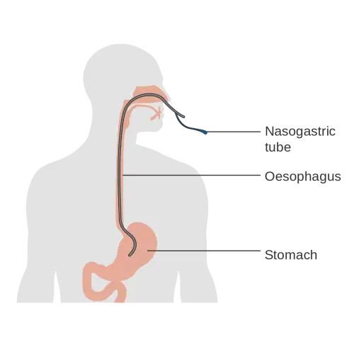 &Epsilon;&nu;&tau;&epsilon;&rho;&iota;&kappa;ή &sigma;ί&tau;&iota;&sigma;&eta;