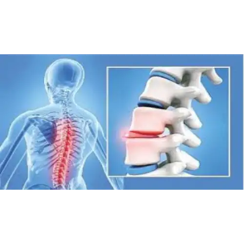 &Kappa;ή&lambda;&eta; &Mu;&epsilon;&sigma;&omicron;&sigma;&pi;&omicron;&nu;&delta;ύ&lambda;&iota;&omicron;&upsilon; &Delta;ί&sigma;&kappa;&omicron;&upsilon; 