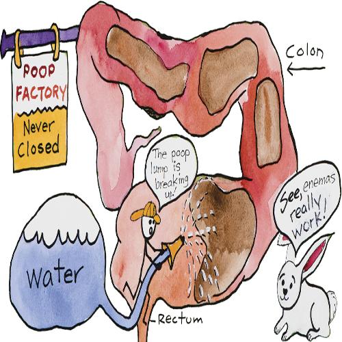 Υποκλυσμός