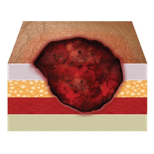 Αλλαγή και περιποίηση κατακλίσεων