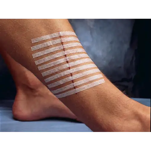 Steri Strip 3M -100*12mm 