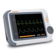 &Sigma;&upsilon;&sigma;&kappa;&epsilon;&upsilon;ή &Pi;&alpha;&rho;&alpha;&kappa;&omicron;&lambda;&omicron;ύ&theta;&eta;&sigma;&eta;&sigmaf; &Zeta;&omega;&tau;&iota;&kappa;ώ&nu; &Pi;&alpha;&rho;&alpha;&mu;έ&tau;&rho;&omega;&nu; (Monitor) | &Mu;&epsilon; Bluetooth