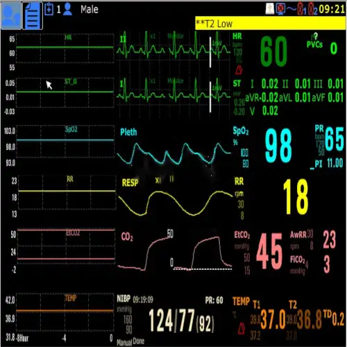 &Mu;ό&nu;&iota;&tau;&omicron;&rho; &Pi;&alpha;&rho;&alpha;&kappa;&omicron;&lambda;&omicron;ύ&theta;&eta;&sigma;&eta;&sigmaf; &Zeta;&omega;&tau;&iota;&kappa;ώ&nu; &lambda;&epsilon;&iota;&tau;&omicron;&upsilon;&rho;&gamma;&iota;ώ&nu; (Monitor ) AURORA 12S