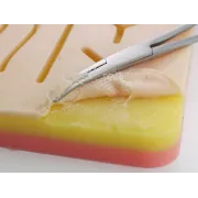 ΕΚΠΑΙΔΕΥΤΙΚΟ ΕΠΙΘΕΜΑ ΓΙΑ ΣΥΡΡΑΦΗ ΤΡΑΥΜΑΤΟΣ