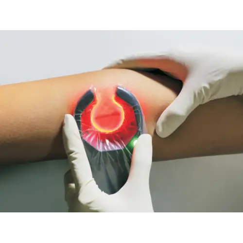 VeinSpy | &Sigma;&upsilon;&sigma;&kappa;&epsilon;&upsilon;ή &Alpha;&nu;ί&chi;&nu;&epsilon;&upsilon;&sigma;&eta;&sigmaf; &Phi;&lambda;&epsilon;&beta;ώ&nu;