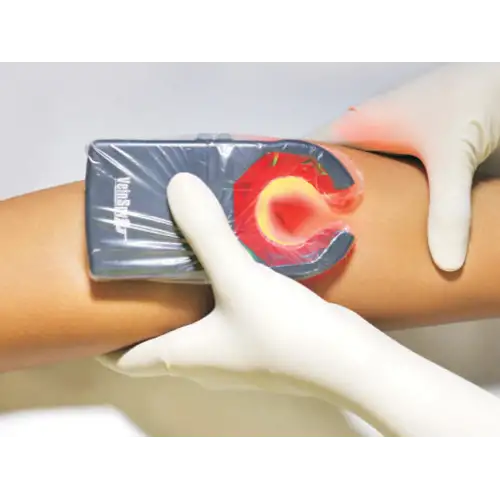 VeinSpy | &Sigma;&upsilon;&sigma;&kappa;&epsilon;&upsilon;ή &Alpha;&nu;ί&chi;&nu;&epsilon;&upsilon;&sigma;&eta;&sigmaf; &Phi;&lambda;&epsilon;&beta;ώ&nu;