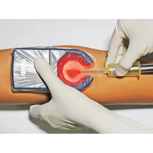 VeinSpy | &Sigma;&upsilon;&sigma;&kappa;&epsilon;&upsilon;ή &Alpha;&nu;ί&chi;&nu;&epsilon;&upsilon;&sigma;&eta;&sigmaf; &Phi;&lambda;&epsilon;&beta;ώ&nu;