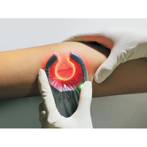 VeinSpy | Συσκευή Ανίχνευσης Φλεβών