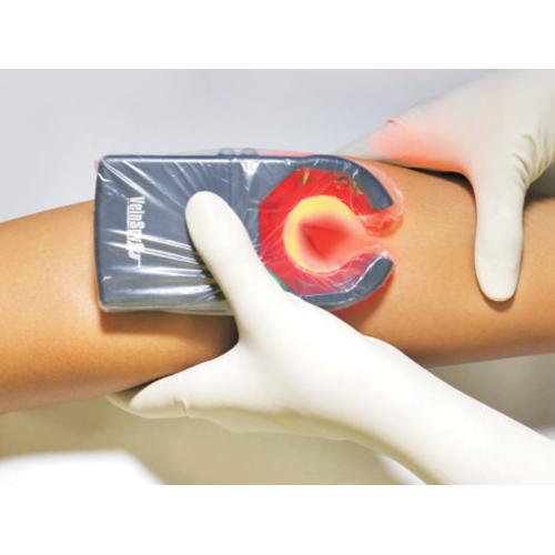 VeinSpy | Συσκευή Ανίχνευσης Φλεβών