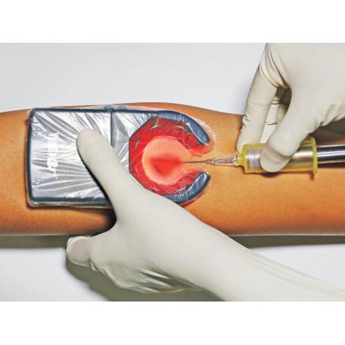 VeinSpy | Συσκευή Ανίχνευσης Φλεβών