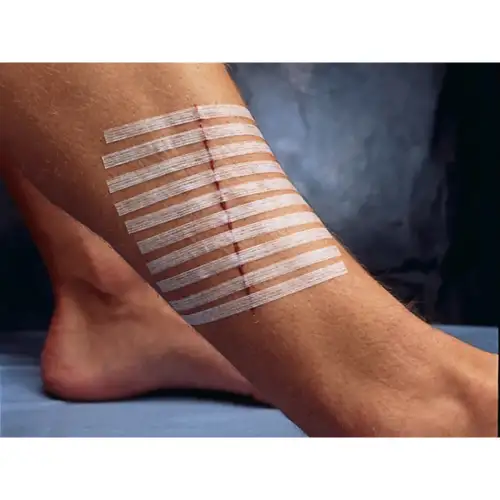 &Alpha;&upsilon;&tau;&omicron;&kappa;ό&lambda;&lambda;&eta;&tau;&alpha; &Rho;ά&mu;&mu;&alpha;&tau;&alpha; 12mm x 100mm - 300&tau;&mu;&chi;. (50 bags &tau;&omega;&nu; 6&tau;&mu;&chi;.) | Steri Strip 3M