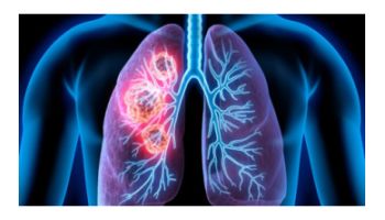 &Kappa;&alpha;&rho;&kappa;ί&nu;&omicron;&sigmaf; &tau;&omicron;&upsilon; &Pi;&nu;&epsilon;ύ&mu;&omicron;&nu;&alpha;: &Alpha;&nu;&tau;&iota;&mu;&epsilon;&tau;&omega;&pi;ί&zeta;&omicron;&nu;&tau;&alpha;&sigmaf; έ&nu;&alpha; &pi;&alpha;&gamma;&kappa;ό&sigma;&mu;&iota;&omicron; &epsilon;&chi;&theta;&rho;ό!