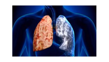 &Chi;&Alpha;&Pi;: &Chi;&rho;ό&nu;&iota;&alpha; &Alpha;&pi;&omicron;&phi;&rho;&alpha;&kappa;&tau;&iota;&kappa;ή &Pi;&nu;&epsilon;&upsilon;&mu;&omicron;&nu;&omicron;&pi;ά&theta;&epsilon;&iota;&alpha; 