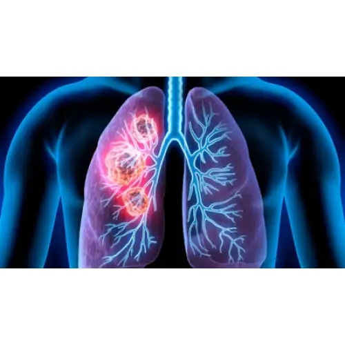 &Kappa;&alpha;&rho;&kappa;ί&nu;&omicron;&sigmaf; &tau;&omicron;&upsilon; &Pi;&nu;&epsilon;ύ&mu;&omicron;&nu;&alpha;: &Alpha;&nu;&tau;&iota;&mu;&epsilon;&tau;&omega;&pi;ί&zeta;&omicron;&nu;&tau;&alpha;&sigmaf; έ&nu;&alpha; &pi;&alpha;&gamma;&kappa;ό&sigma;&mu;&iota;&omicron; &epsilon;&chi;&theta;&rho;ό!