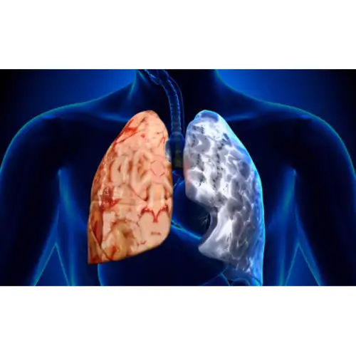 &Chi;&Alpha;&Pi;: &Chi;&rho;ό&nu;&iota;&alpha; &Alpha;&pi;&omicron;&phi;&rho;&alpha;&kappa;&tau;&iota;&kappa;ή &Pi;&nu;&epsilon;&upsilon;&mu;&omicron;&nu;&omicron;&pi;ά&theta;&epsilon;&iota;&alpha; 