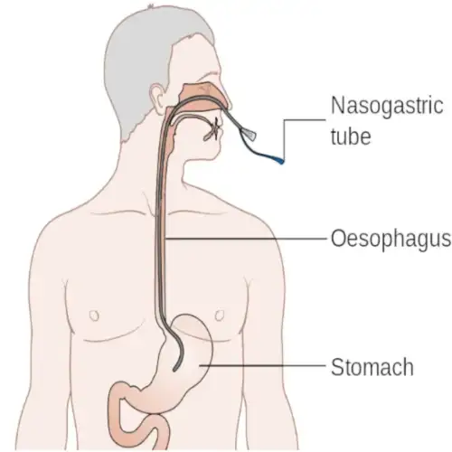 &Kappa;&alpha;&theta;&epsilon;&tau;ή&rho;&alpha;&sigmaf; &Sigma;ί&tau;&iota;&sigma;&eta;&sigmaf; (Levin) - 125cm | &Sigma;&upsilon;&sigma;&kappa;: 5 &Tau;&mu;&chi; | &Nu;&omicron; 16 &Pi;&omicron;&rho;&tau;&omicron;&kappa;&alpha;&lambda;ί