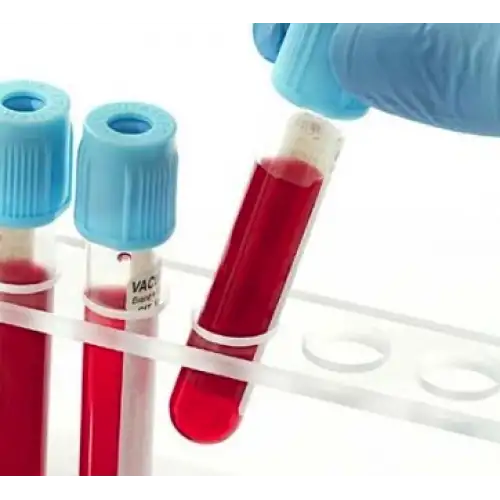 &Alpha;&iota;&mu;&omicron;&lambda;&eta;&psi;ί&alpha;